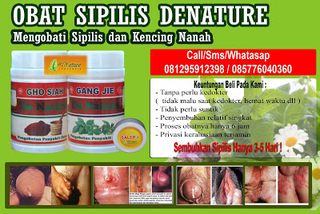 Illustration for article titled Keluar cairan putih
Susu Kental Dan Bau saat kencing
